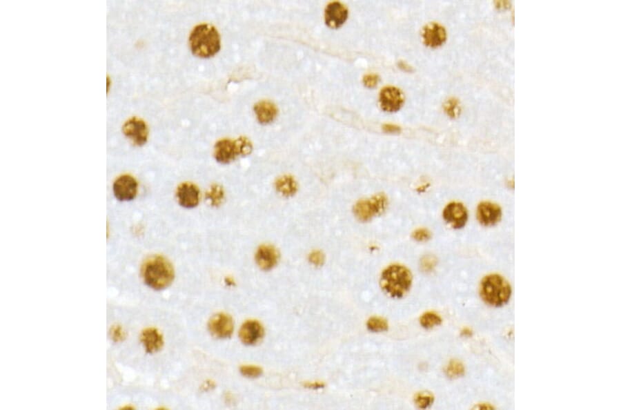 Immunohistochemistry - Anti-Vitamin D Receptor Antibody (A81184) - Antibodies.com