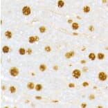 Immunohistochemistry - Anti-Vitamin D Receptor Antibody (A81184) - Antibodies.com
