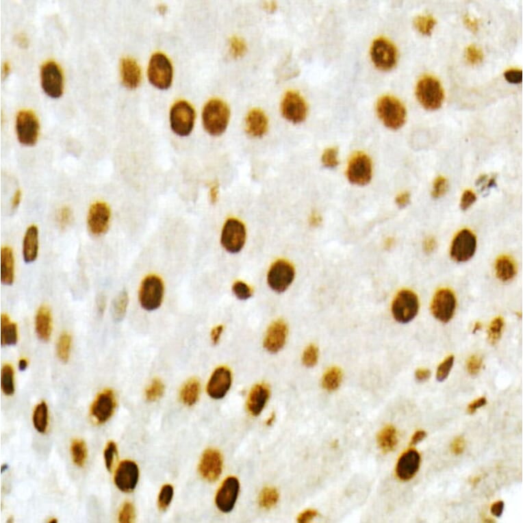 Immunohistochemistry - Anti-Vitamin D Receptor Antibody (A81184) - Antibodies.com