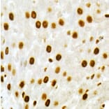 Immunohistochemistry - Anti-Vitamin D Receptor Antibody (A81184) - Antibodies.com