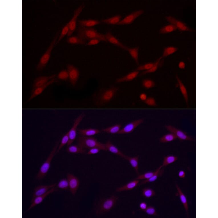 Immunofluorescence - Anti-Vitamin D Receptor Antibody (A81184) - Antibodies.com