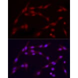 Immunofluorescence - Anti-Vitamin D Receptor Antibody (A81184) - Antibodies.com