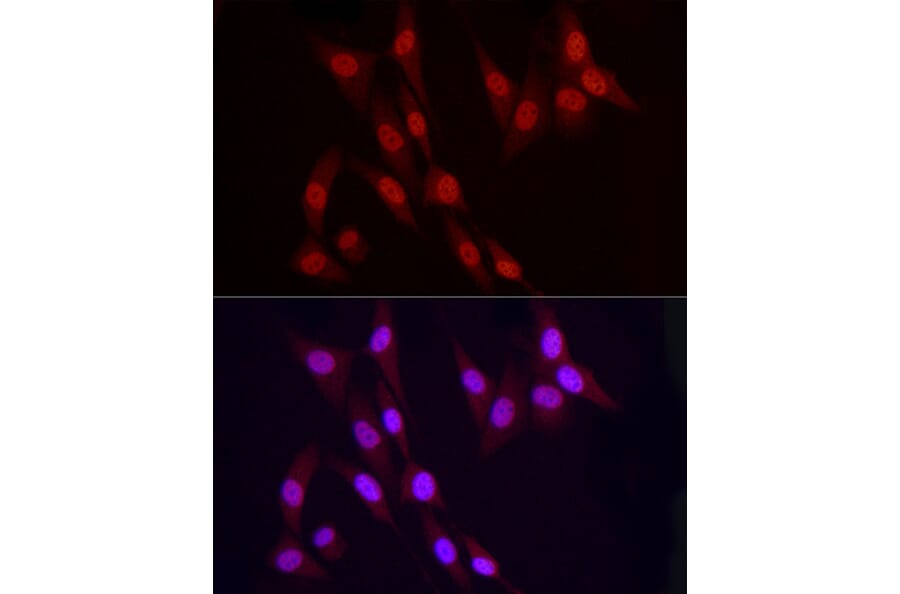 Immunofluorescence - Anti-Vitamin D Receptor Antibody (A81184) - Antibodies.com