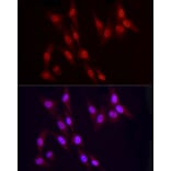 Immunofluorescence - Anti-Vitamin D Receptor Antibody (A81184) - Antibodies.com