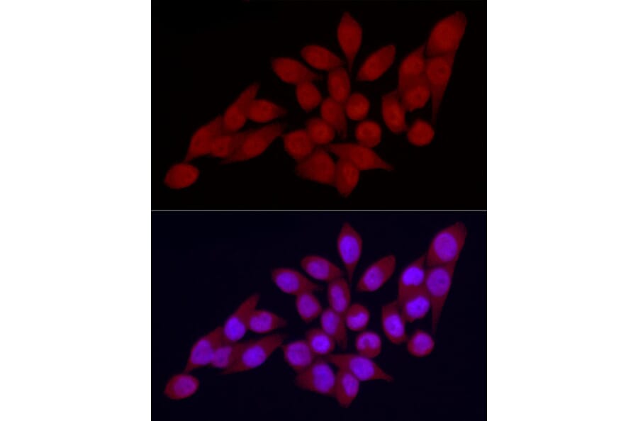 Immunofluorescence - Anti-Vitamin D Receptor Antibody (A81184) - Antibodies.com