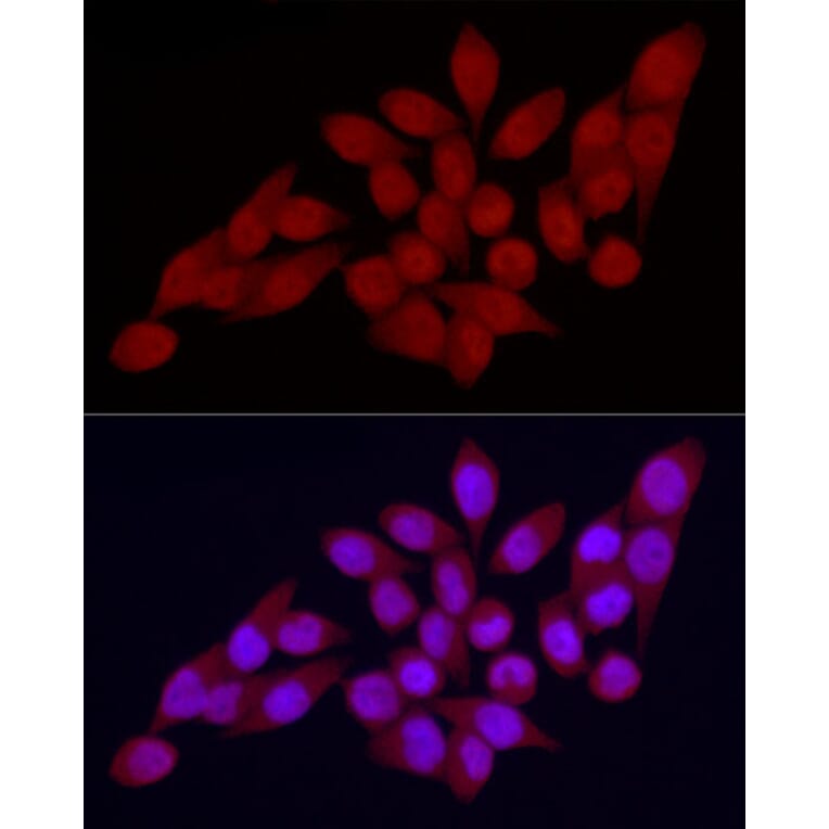 Immunofluorescence - Anti-Vitamin D Receptor Antibody (A81184) - Antibodies.com