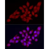 Immunofluorescence - Anti-Vitamin D Receptor Antibody (A81184) - Antibodies.com