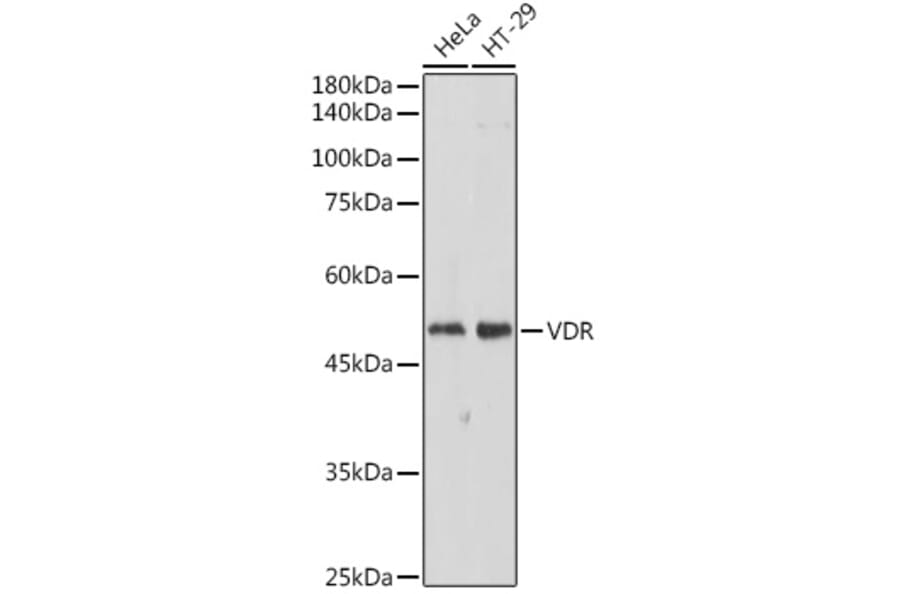 Western Blot - Anti-Vitamin D Receptor Antibody (A81185) - Antibodies.com