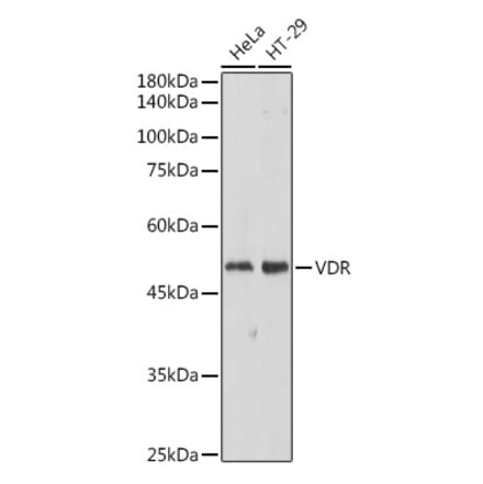 Western Blot - Anti-Vitamin D Receptor Antibody (A81185) - Antibodies.com