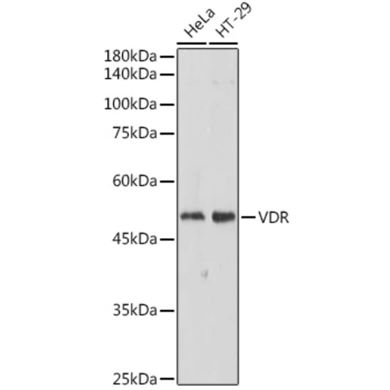 Western Blot - Anti-Vitamin D Receptor Antibody (A81185) - Antibodies.com