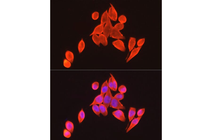 Immunofluorescence - Anti-Vitamin D Receptor Antibody (A81185) - Antibodies.com