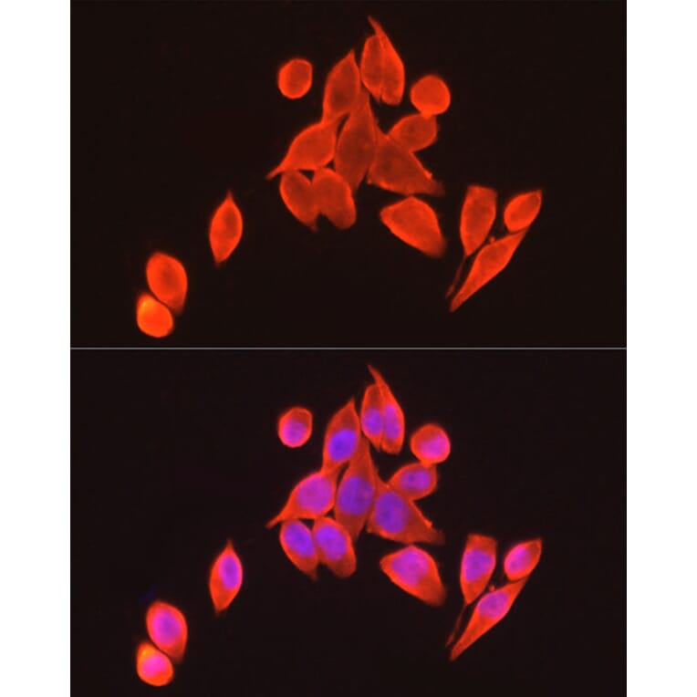Immunofluorescence - Anti-Vitamin D Receptor Antibody (A81185) - Antibodies.com