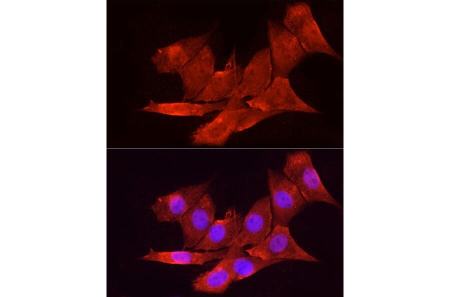 Immunofluorescence - Anti-Vitamin D Receptor Antibody (A81185) - Antibodies.com