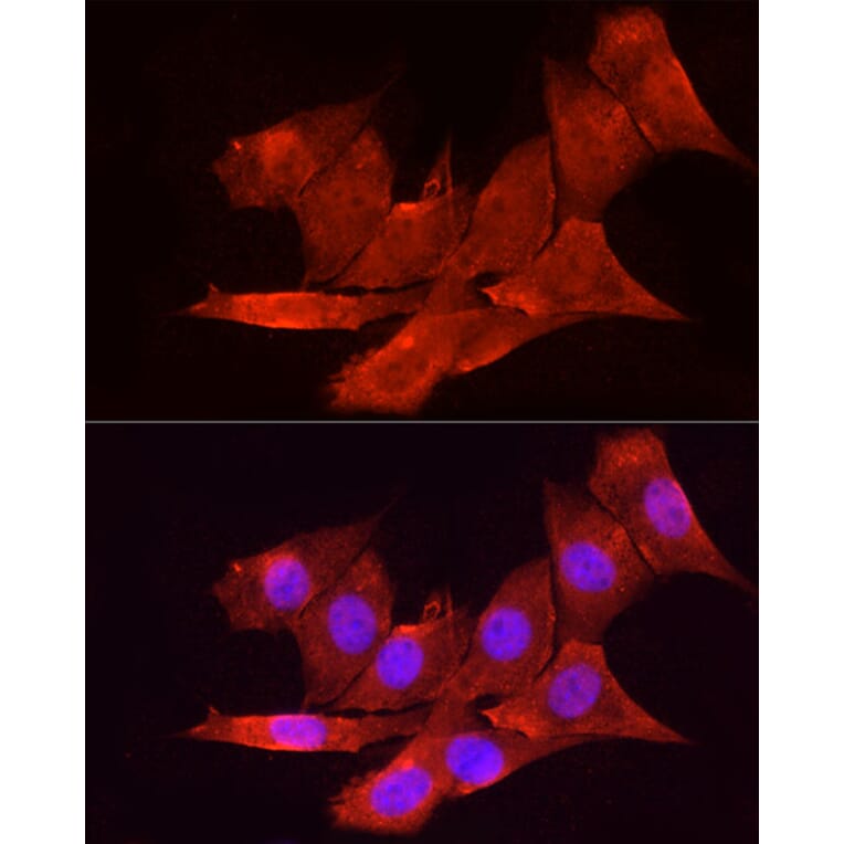 Immunofluorescence - Anti-Vitamin D Receptor Antibody (A81185) - Antibodies.com