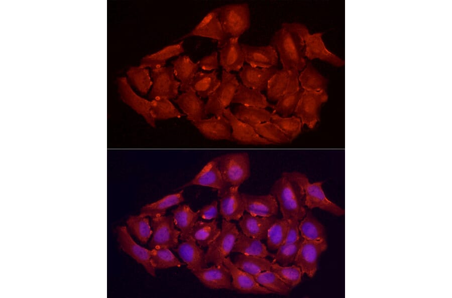 Immunofluorescence - Anti-Vitamin D Receptor Antibody (A81185) - Antibodies.com