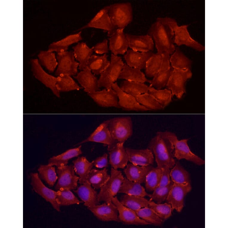 Immunofluorescence - Anti-Vitamin D Receptor Antibody (A81185) - Antibodies.com