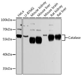 Western Blot - Anti-Catalase Antibody (A81186) - Antibodies.com