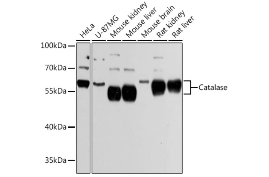 Western Blot - Anti-Catalase Antibody (A81186) - Antibodies.com