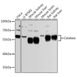 Western Blot - Anti-Catalase Antibody (A81186) - Antibodies.com