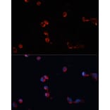 Immunofluorescence - Anti-Catalase Antibody (A81186) - Antibodies.com