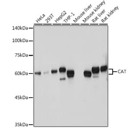 Western Blot - Anti-Catalase Antibody (A81187) - Antibodies.com