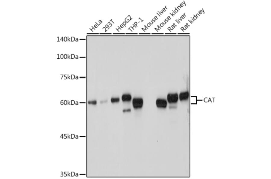 Western Blot - Anti-Catalase Antibody (A81187) - Antibodies.com