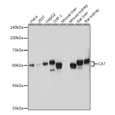 Western Blot - Anti-Catalase Antibody (A81187) - Antibodies.com