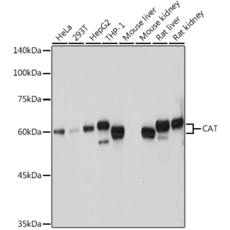 Western Blot - Anti-Catalase Antibody (A81187) - Antibodies.com