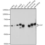 Western Blot - Anti-Catalase Antibody (A81187) - Antibodies.com