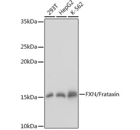 Western Blot - Anti-Frataxin Antibody (A81189) - Antibodies.com