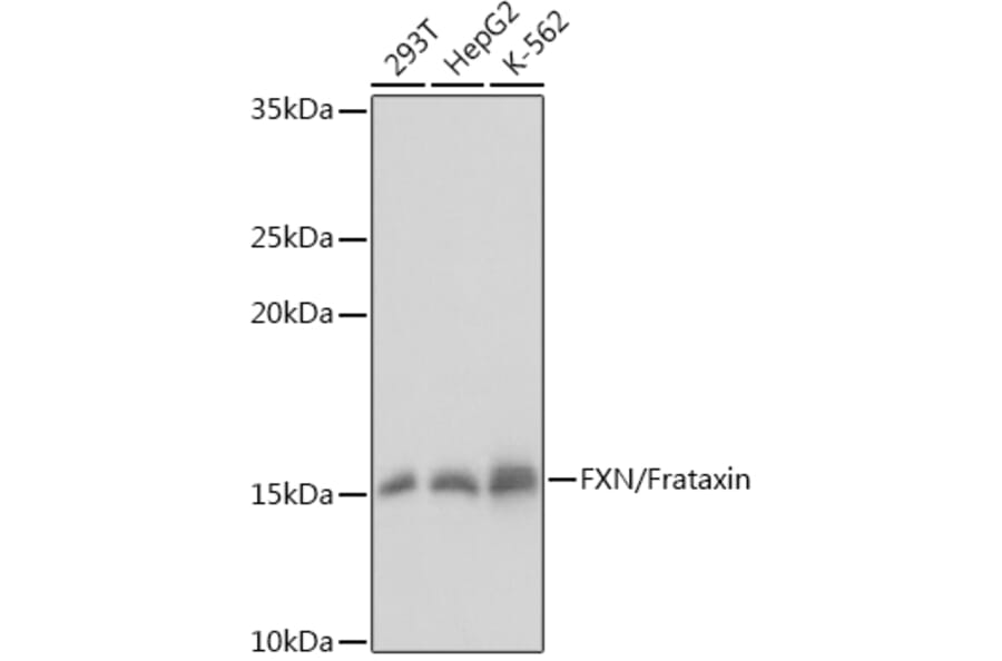 Western Blot - Anti-Frataxin Antibody (A81189) - Antibodies.com