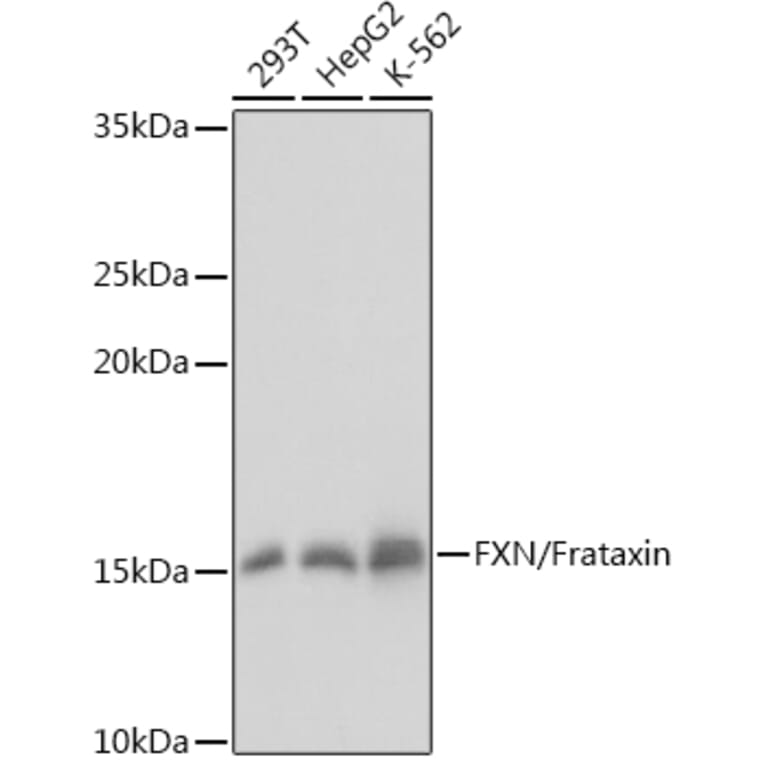 Western Blot - Anti-Frataxin Antibody (A81189) - Antibodies.com