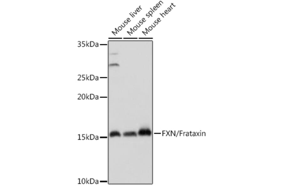 Western Blot - Anti-Frataxin Antibody (A81189) - Antibodies.com