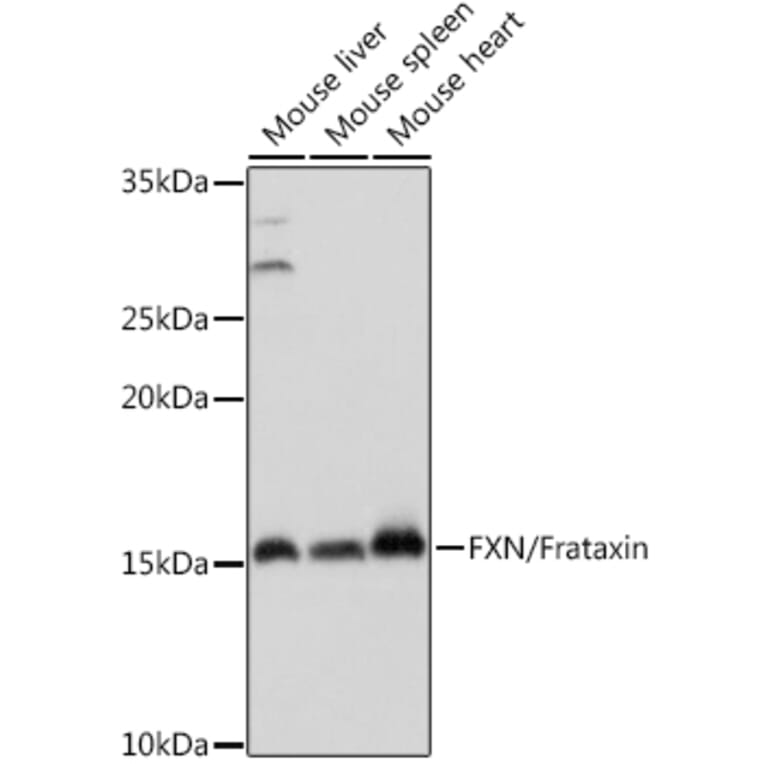 Western Blot - Anti-Frataxin Antibody (A81189) - Antibodies.com