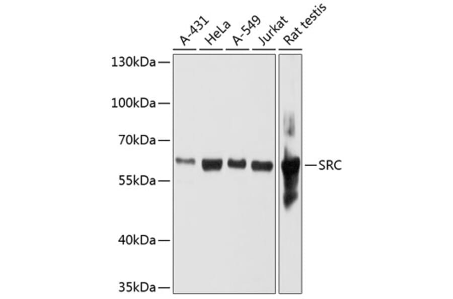 Western Blot - Anti-SRC Antibody (A11798) - Antibodies.com