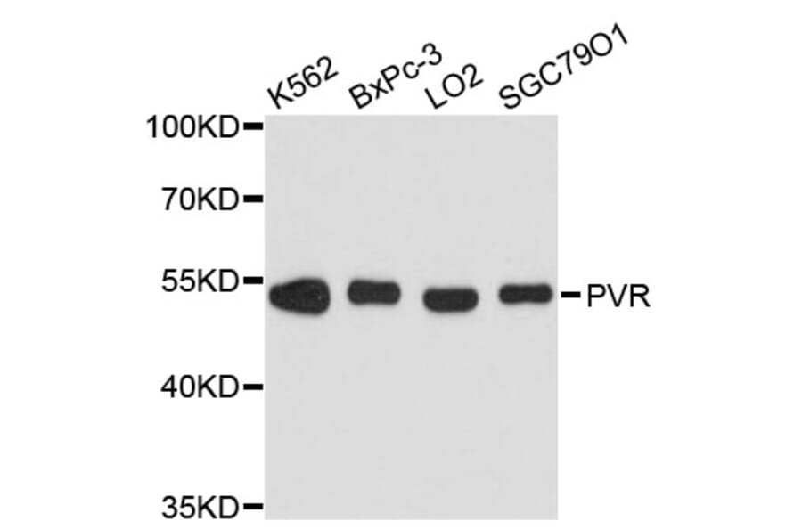 Western Blot - Anti-PVR Antibody (A11824) - Antibodies.com