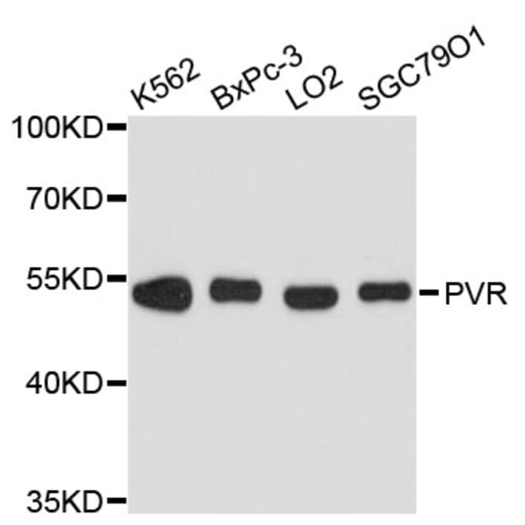 Western Blot - Anti-PVR Antibody (A11824) - Antibodies.com