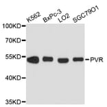 Western Blot - Anti-PVR Antibody (A11824) - Antibodies.com