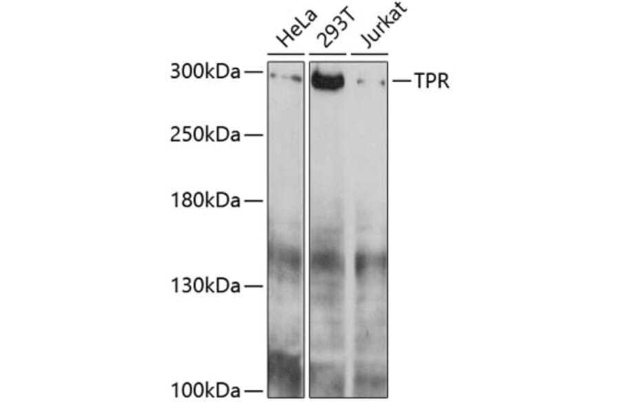 Western Blot - Anti-TPR Antibody (A11835) - Antibodies.com
