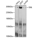 Western Blot - Anti-TPR Antibody (A11835) - Antibodies.com