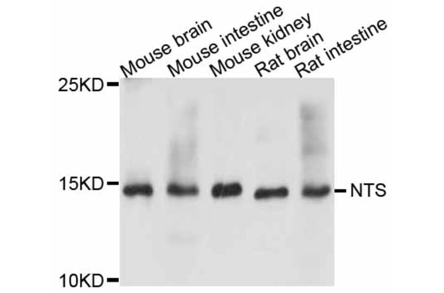 Western Blot - Anti-NTS Antibody (A11837) - Antibodies.com