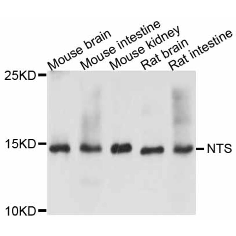 Western Blot - Anti-NTS Antibody (A11837) - Antibodies.com
