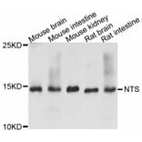 Western Blot - Anti-NTS Antibody (A11837) - Antibodies.com