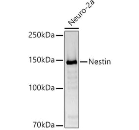 Western Blot - Anti-Nestin Antibody (A81194) - Antibodies.com