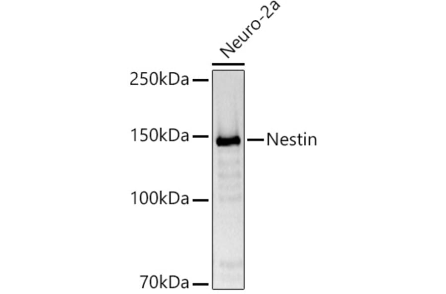 Western Blot - Anti-Nestin Antibody (A81194) - Antibodies.com