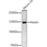 Western Blot - Anti-Nestin Antibody (A81194) - Antibodies.com