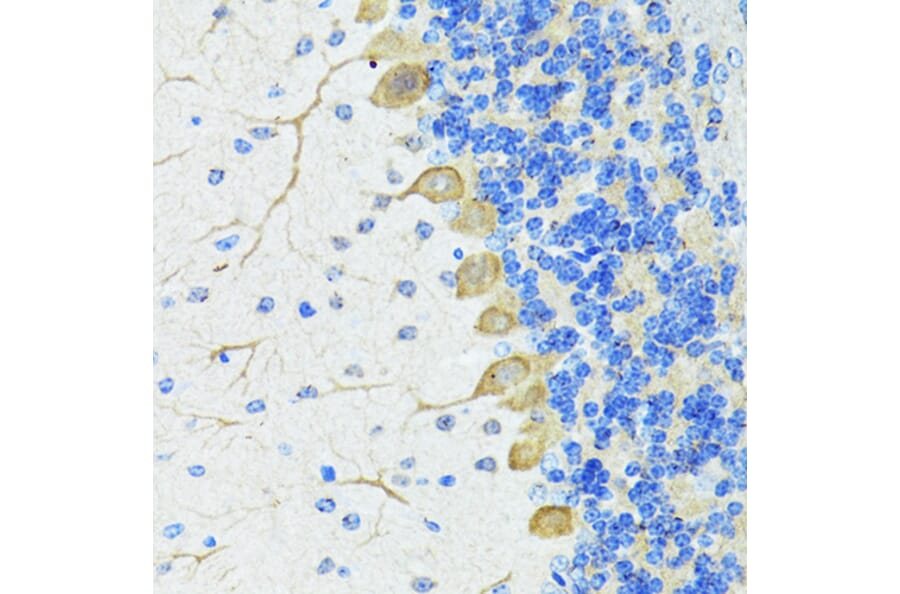 Immunohistochemistry - Anti-Nestin Antibody (A81194) - Antibodies.com