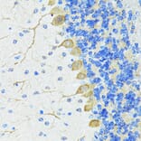 Immunohistochemistry - Anti-Nestin Antibody (A81194) - Antibodies.com