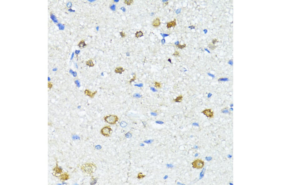 Immunohistochemistry - Anti-Nestin Antibody (A81194) - Antibodies.com