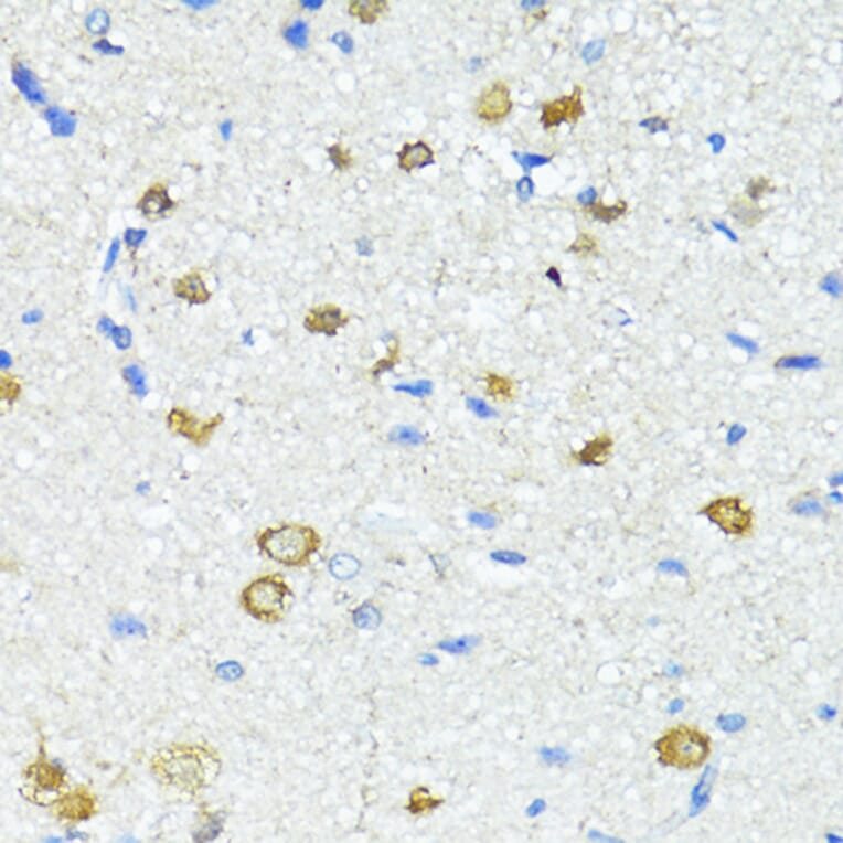 Immunohistochemistry - Anti-Nestin Antibody (A81194) - Antibodies.com